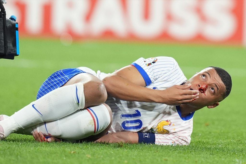 Mbappe je glavom udario u rame austrijskog igrača Dansa pri čemu je slomio nos / Foto: Anadolu