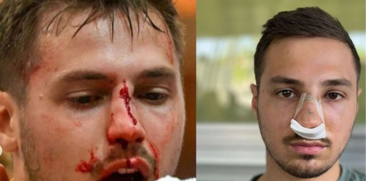 Ozlijeđeni rukometaš Markus Mehr / Foto: Instagram/bregenz_handball)
