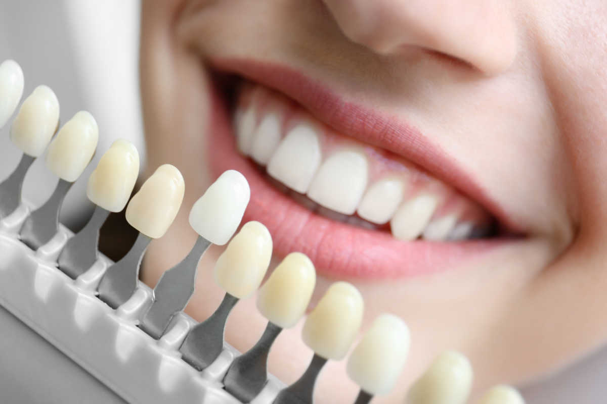 Zahn-OP & Bleaching: Tipps vor und nach dem Eingriff